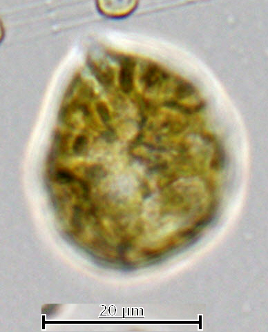 Рис. 12. Динофлагеллята Scrippsiella trochoidea