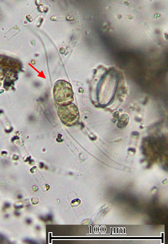 Рис. 13. Динофлагеллята Dissodinium pseudolunula, указана красной стрелкой