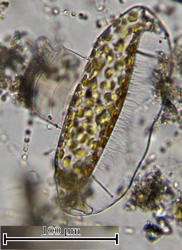 Рис. 2. Диатомея Odontella sinensis . прорастающая спора