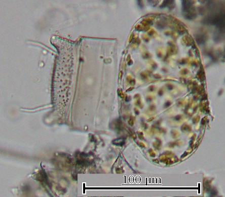 Рис. 3. Диатомея Odontella sinensis, спора, прикрепленная к створке