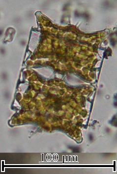 Рис. 4. Диатомея Odontella aurita, колония из 2-х клеток