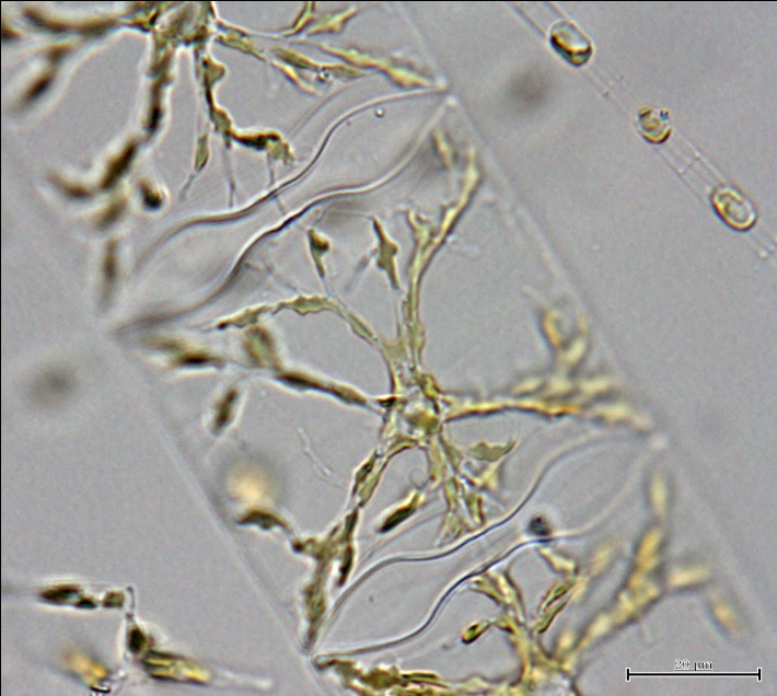 Рис. 6. Диатомея Bellerochea malleus, клетка со звездчатым хлоропластом