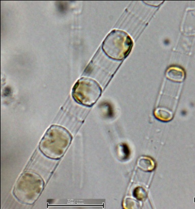 Рис. 8. Диатомея Sceletonema costatum, колонии из клеток разного размера